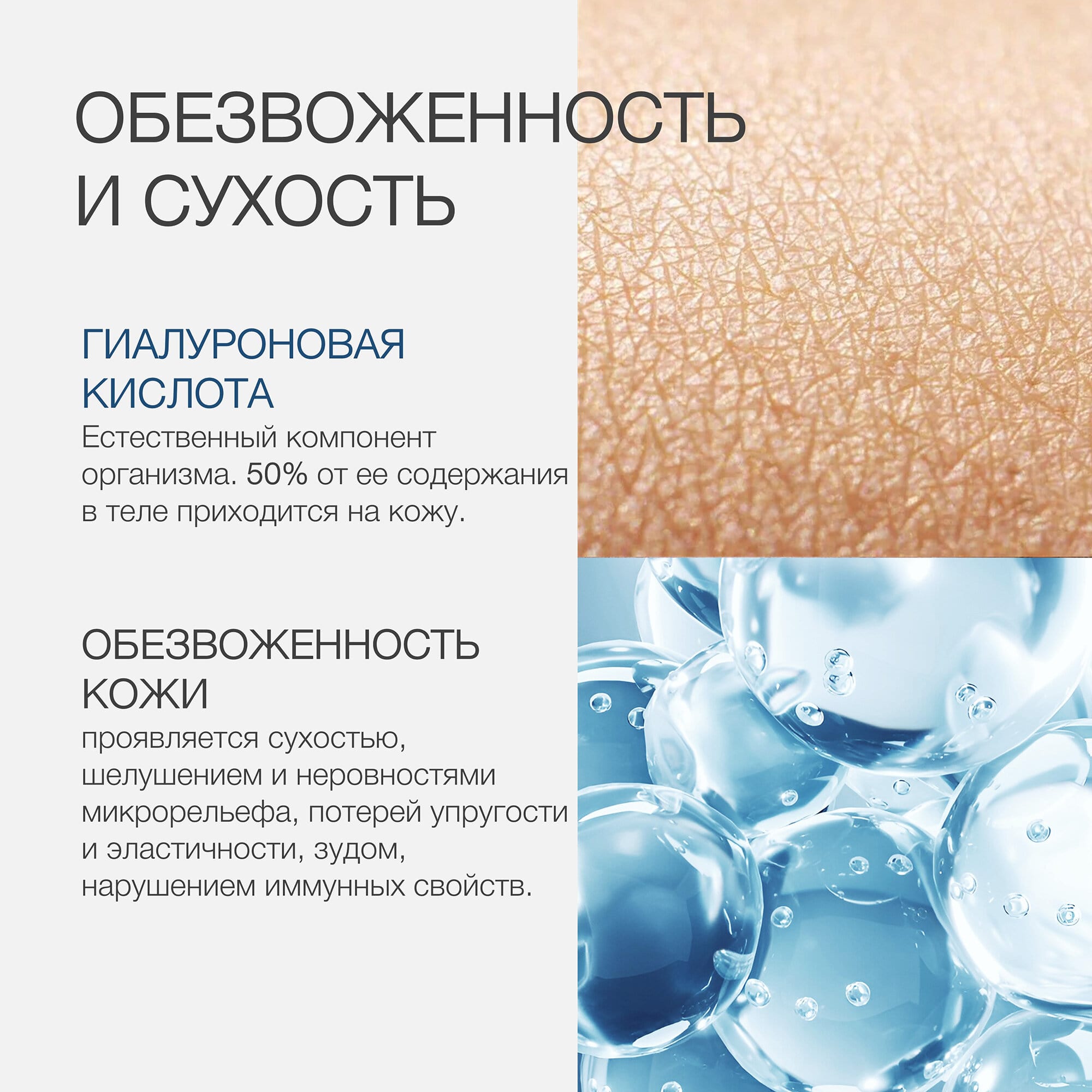 Пост гиалуроновая кислота 3.jpg Пост гиалуроновая кислота 3.jpg